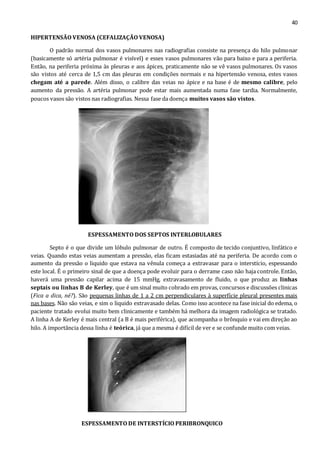 40 
HIPERTENSÃO VENOSA (CEFALIZAÇÃO VENOSA) 
O padrão normal dos vasos pulmonares nas radiografias consiste na presença do hilo pulmonar 
(basicamente só artéria pulmonar é visível) e esses vasos pulmonares vão para baixo e para a periferia. 
Então, na periferia próxima às pleuras e aos ápices, praticamente não se vê vasos pulmonares. Os vasos 
são vistos até cerca de 1,5 cm das pleuras em condições normais e na hipertensão venosa, estes vasos 
chegam até a parede. Além disso, o calibre das veias no ápice e na base é de mesmo calibre, pelo 
aumento da pressão. A artéria pulmonar pode estar mais aumentada numa fase tardia. Normalmente, 
poucos vasos são vistos nas radiografias. Nessa fase da doença muitos vasos são vistos. 
ESPESSAMENTO DOS SEPTOS INTERLOBULARES 
Septo é o que divide um lóbulo pulmonar de outro. É composto de tecido conjuntivo, linfático e 
veias. Quando estas veias aumentam a pressão, elas ficam estasiadas até na periferia. De acordo com o 
aumento da pressão o liquido que estava na vênula começa a extravasar para o interstício, espessando 
este local. É o primeiro sinal de que a doença pode evoluir para o derrame caso não haja controle. Então, 
haverá uma pressão capilar acima de 15 mmHg, extravasamento de fluido, o que produz as linhas 
septais ou linhas B de Kerley, que é um sinal muito cobrado em provas, concursos e discussões clinicas 
(Fica a dica, né?). São pequenas linhas de 1 a 2 cm perpendiculares à superfície pleural presentes mais 
nas bases. Não são veias, e sim o liquido extravasado delas. Como isso acontece na fase inicial do edema, o 
paciente tratado evolui muito bem clinicamente e também há melhora da imagem radiológica se tratado. 
A linha A de Kerley é mais central (a B é mais periférica), que acompanha o brônquio e vai em direção ao 
hilo. A importância dessa linha é teórica, já que a mesma é difícil de ver e se confunde muito com veias. 
ESPESSAMENTO DE INTERSTÍCIO PERIBRONQUICO 
 