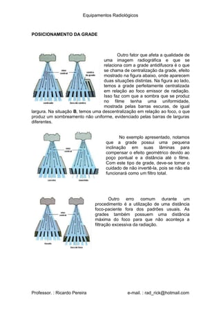 Equipamentos Radiológicos
POSICIONAMENTO DA GRADE
Outro fator que afeta a qualidade de
uma imagem radiográfica e que se
relaciona com a grade antidifusora é o que
se chama de centralização da grade, efeito
mostrado na figura abaixo, onde aparecem
duas situações distintas. Na figura ao lado,
temos a grade perfeitamente centralizada
em relação ao foco emissor de radiação.
Isso faz com que a sombra que se produz
no filme tenha uma uniformidade,
mostrada pelas barras escuras, de igual
largura. Na situação B, temos uma descentralização em relação ao foco, o que
produz um sombreamento não uniforme, evidenciado pelas barras de larguras
diferentes.
No exemplo apresentado, notamos
que a grade possui uma pequena
inclinação em suas lâminas para
compensar o efeito geométrico devido ao
poço pontual e a distância até o filme.
Com este tipo de grade, deve-se tomar o
cuidado de não invertê-la, pois se não ela
funcionará como um filtro total.
Outro erro comum durante um
procedimento é a utilização de uma distância
foco-paciente fora dos padrões usuais. As
grades também possuem uma distância
máxima do foco para que não aconteça a
filtração excessiva da radiação.
Professor. : Ricardo Pereira e-mail. : rad_rick@hotmail.com
 