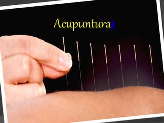 Acupuntura
 