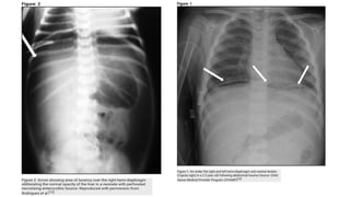 Gambaran dan Ekspertise Radiologi Abdomen.pptx
