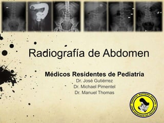 Radiografía de Abdomen
Médicos Residentes de Pediatría
Dr. José Gutiérrez
Dr. Michael Pimentel
Dr. Manuel Thomas
 