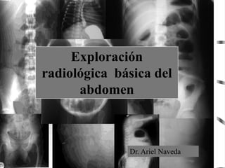 Exploración
radiológica básica del
abdomen
Dr. Ariel Naveda
 