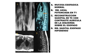 Radiologia de esofago y estomago | PPTX