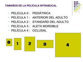 TAMAÑOS DE LA PELÍCULA INTRABUCAL PELICULA 0 :  PEDIÁTRICA PELÍCULA 1 :  ANTERIOR DEL ADULTO PELÍCULA 2 :  STANDARD DEL ADULTO PELÍCULA 3 :  ALETA MORDIBLE PELÍCULA 4 :  OCLUSAL 1 0 2 3 4 