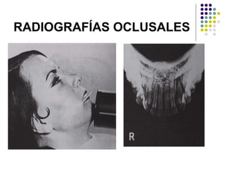 RADIOGRAFÍAS OCLUSALES 