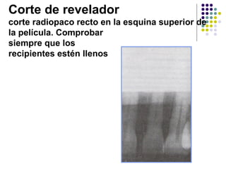 Corte de revelador  corte radiopaco recto en la esquina superior de la película. Comprobar  siempre que los  recipientes estén llenos 