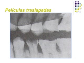 Películas traslapadas 
