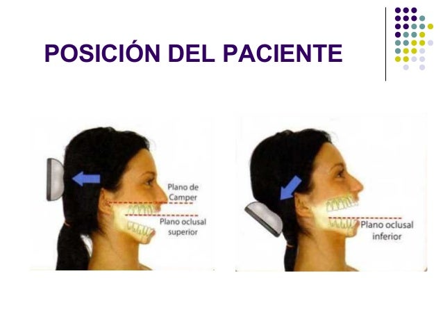 Resultado de imagen para PELICULAS INTRAORALES PACIENTES