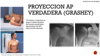 Comprehensive Radiological Techniques and Measurements for Shoulder ...
