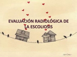 EVALUACIÓN RADIOLÓGICA DE
LA ESCOLIOSIS

 