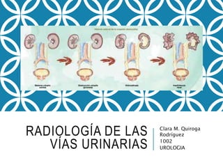 RADIOLOGÍA DE LAS
VÍAS URINARIAS
Clara M. Quiroga
Rodríguez
1002
UROLOGIA
 