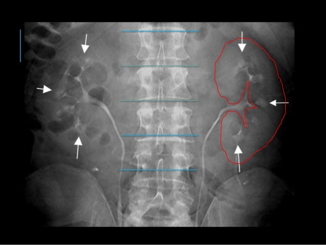 Estudios radiologicos de las vias urinarias