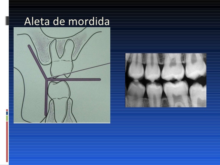 Radiologia Dental Y Maxilofacial