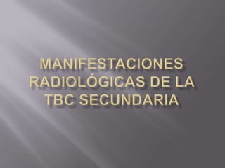 Manifestaciones radiológicas de la tbc secundaria 
