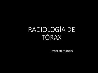 RADIOLOGÌA DE
TÓRAX
Javier Hernández
 
