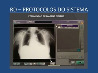 RD – PROTOCOLOS DO SISTEMA
 
