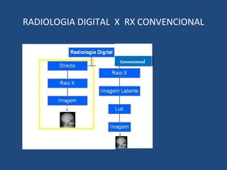 RADIOLOGIA DIGITAL X RX CONVENCIONAL
ConvencionalConvencional
 