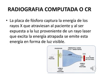RADIOGRAFIA COMPUTADA O CR
• La placa de fósforo captura la energía de los
rayos X que atraviesan al paciente y al ser
expuesta a la luz proveniente de un rayo laser
que excita la energía atrapada se emite esta
energía en forma de luz visible.
 