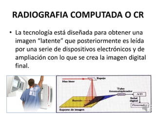 RADIOGRAFIA COMPUTADA O CR
• La tecnología está diseñada para obtener una
imagen “latente” que posteriormente es leída
por una serie de dispositivos electrónicos y de
ampliación con lo que se crea la imagen digital
final.
 
