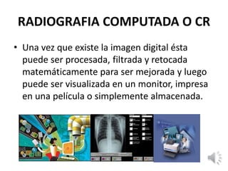 RADIOGRAFIA COMPUTADA O CR
• Una vez que existe la imagen digital ésta
puede ser procesada, filtrada y retocada
matemáticamente para ser mejorada y luego
puede ser visualizada en un monitor, impresa
en una película o simplemente almacenada.
 