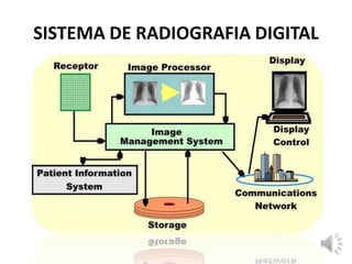 SISTEMA DE RADIOGRAFIA DIGITAL
 