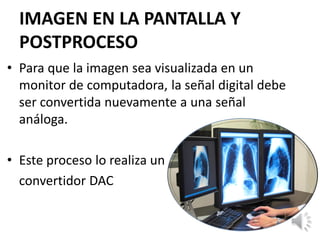 IMAGEN EN LA PANTALLA Y
POSTPROCESO
• Para que la imagen sea visualizada en un
monitor de computadora, la señal digital debe
ser convertida nuevamente a una señal
análoga.
• Este proceso lo realiza un
convertidor DAC
 
