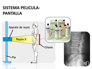 SISTEMA PELICULA-
PANTALLA
 