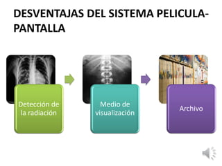 DESVENTAJAS DEL SISTEMA PELICULA-
PANTALLA
Detección de
la radiación
Medio de
visualización
Archivo
 
