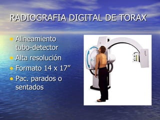 RADIOGRAFIA DIGITAL DE TORAX Alineamiento tubo-detector Alta resolución Formato 14 x 17” Pac. parados o sentados 