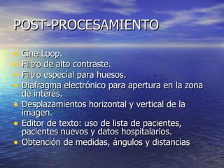 POST-PROCESAMIENTO Cine Loop. Filtro de alto contraste. Filtro especial para huesos. Diafragma electrónico para apertura en la zona de interés. Desplazamientos horizontal y vertical de la imagen. Editor de texto: uso de lista de pacientes, pacientes nuevos y datos hospitalarios. Obtención de medidas, ángulos y distancias  