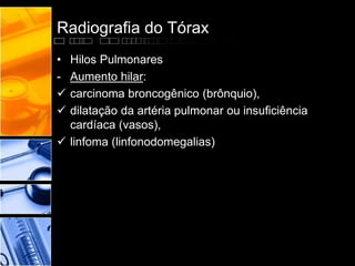 Radiografia do Tórax 
• Hilos Pulmonares 
- Aumento hilar: 
 carcinoma broncogênico (brônquio), 
 dilatação da artéria pulmonar ou insuficiência 
cardíaca (vasos), 
 linfoma (linfonodomegalias) 
 