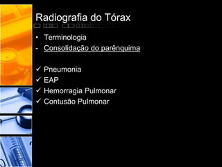 Radiografia do Tórax 
• Terminologia 
- Consolidação do parênquima 
 Pneumonia 
 EAP 
 Hemorragia Pulmonar 
 Contusão Pulmonar 
 