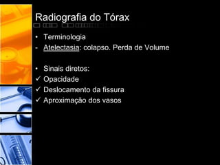 Radiografia do Tórax 
• Terminologia 
- Atelectasia: colapso. Perda de Volume 
• Sinais diretos: 
 Opacidade 
 Deslocamento da fissura 
 Aproximação dos vasos 
 