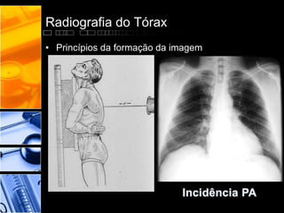 Radiografia do Tórax 
• Princípios da formação da imagem 
 