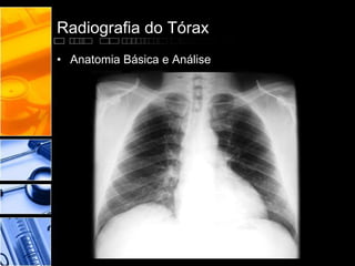 Radiografia do Tórax 
• Anatomia Básica e Análise 
 