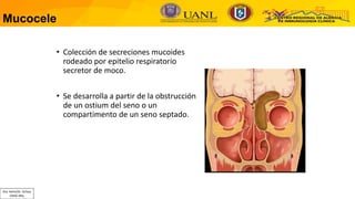 Radiología en enfermedades alérgicas y respiratorias | PDF