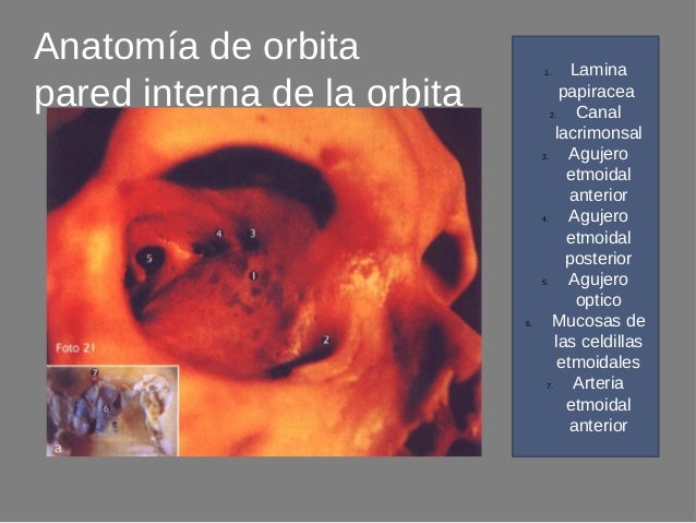 Radiologia en oftalmologia