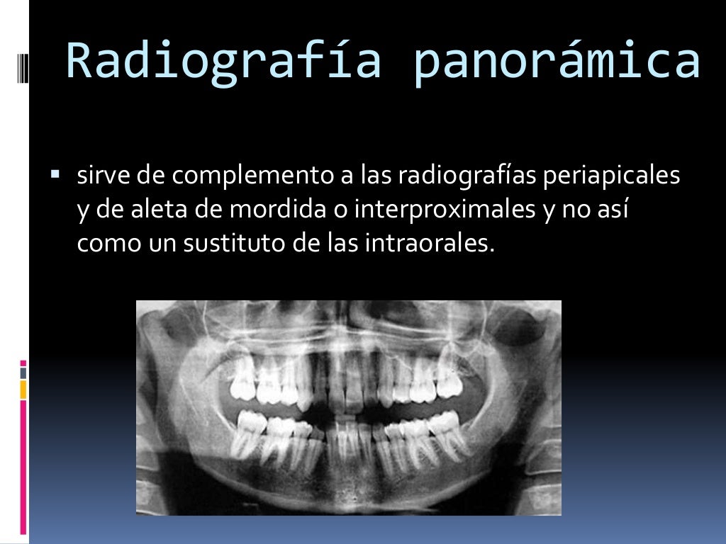 Radiologia extrabucal