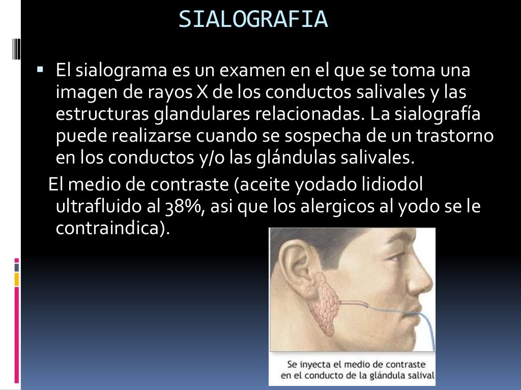 Radiologia extrabucal
