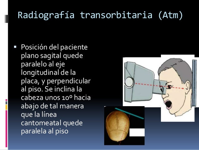 Radiologiaextrabucal