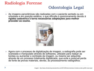  As imagens panorâmicas são realizadas com o paciente sentado ou em
ortostase e em posição estática, o que dificulta o posicionamento devido à
rigidez cadavérica e torna necessárias adaptações para melhor
proceder ao exame.
 Agora com o processo de digitalização de imagem, a radiografia pode ser
scaneada e manipulado através de softwares, utilizado para realçar as
bordas ou aumentar o contraste da imagem, ou mesmo ser adquirida
através de um processo totalmente digitalizado, que evite a possível perda
de fonte de provas materiais, devido, ao processamento radiográfico.
Imagem : http://www.orthodonticproductsonline.com/2014/05/instrumentarium-dental-unveils-op300-maxio-aao/
Radiologia Forense
Odontologia Legal
 