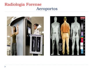 Radiologia Forense
Aeroportos
 