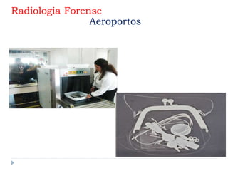 Radiologia Forense
Aeroportos
 