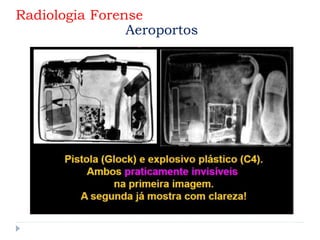 Radiologia Forense
Aeroportos
 