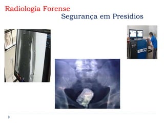 Radiologia Forense
Segurança em Presídios
 