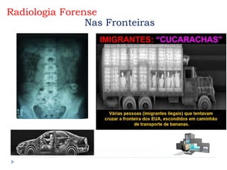 Radiologia Forense
Nas Fronteiras
 