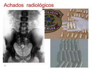 Achados radiológicos
 