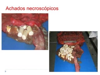 Achados necroscópicos
 