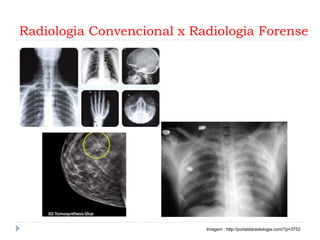 Radiologia Convencional x Radiologia Forense
Imagem : http://portaldaradiologia.com/?p=3752
 