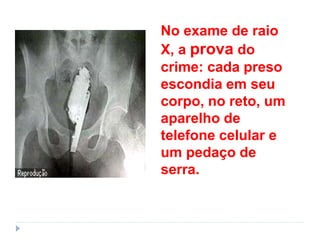 No exame de raio
X, a prova do
crime: cada preso
escondia em seu
corpo, no reto, um
aparelho de
telefone celular e
um pedaço de
serra.
 